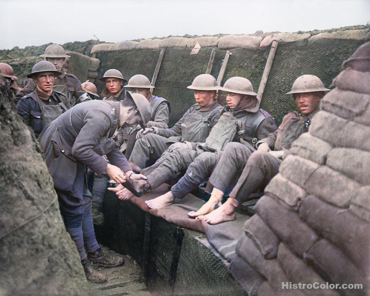 Trench Foot Inspection WW1